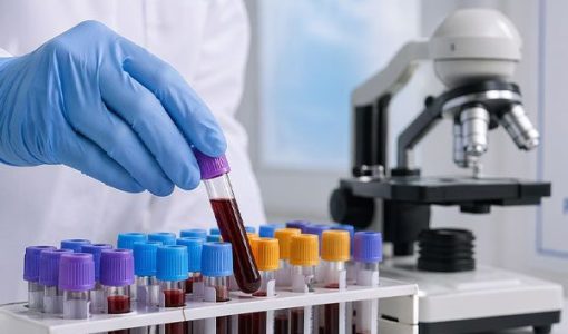 foto-saude-municipal-garante-contrato-de-r-44-milhoes-para-exames-em-pocos-de-caldas-22-04-26